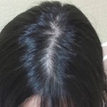야 나 <b>탈모</b> ㅈㄴ 심한거같은데 어카냐ㅠㅠㅠ