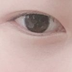 눈매교정 해야할까 평가좀