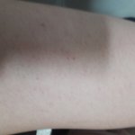 [조언부탁해] 내 다리 어떡해 진짜(혐주의