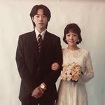 [조언부탁해] 이거이거 여드름 <b>화농성</b>이야?ㅠㅠㅠㅠ제발 도와줘