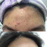 [드루와] 혐주의)나 피부 ㅈㄴ <b>조아짐</b> ㄹㅇ