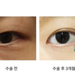 이분 전에 <b>눈</b> 그냥 <b>내눈</b>이랑 개똑인데