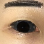[<b>댓글</b>부탁해] 내 피부<b>상태</b> 봐주라 제발ㅠㅠㅠㅠ