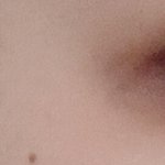 [댓글부탁해] 쌍수할 눈 좀 봐줘ㅠㅠ