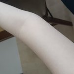 [드루와] <b>팔뚝</b>살어느정도야???