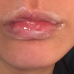 입술거친애들 <b>바세린</b> 얹으셈(?)