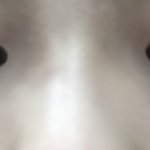[댓글부탁해] 얘들아 이런 <b>노답</b>코는 어떻게해