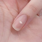손톱에 <b>하얀색</b> 대체 왜생기는거임