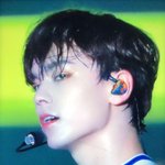 세븐틴 <b>버논</b> 최근 얼굴 상태