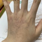 [댓글부탁해] 나 손 <b>핏줄</b>터짐 ㅎㅎㅎ