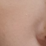 [이것좀봐줘] 내피부좀 살려줘...