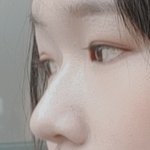 [댓글부탁해] 코 <b>필러</b> 맞말