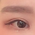 [19] +추가) <b>쌍수</b> 망한 거 맞지 ㅠㅠ