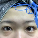 나 오늘 아침에 얼굴 오지게부었었음