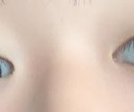 쌍수 하는게 나을까?