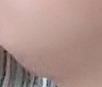 [댓글부탁해] <b>무턱</b> 턱살의 슬픔...