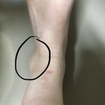 <b>발목</b> 부은 거 같음???