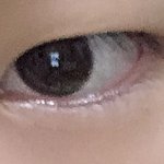 나 쌍수하면 성공할 것 같음?