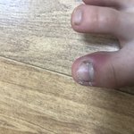 [드루와] 애들아 내발에 <b>염증</b>났는데