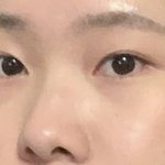 코랑 쌍수 하고 싶은데