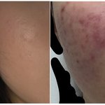 [드루와] 피부 화장 꿀팁 줄겡 피부 안좋은 애들 들어와봐 ㅎㅎ