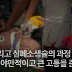 심폐<b>소생</b>술의 비밀