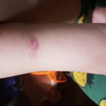 [이것좀봐줘] 어린이집 아동학대 피해자엄마입니다..