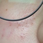 [댓글부탁해] 내 스킨<b>케어</b> 문제점 좀 짚어주라 ㅠㅠ