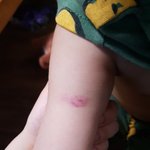 [개깊은빡침] 어린이집 <b>아동</b>학대 피해자 엄마입니다..도와주세요