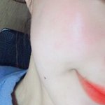 이<b>정도</b> <b>피부</b>면 ㅅㅌㅊ야?
