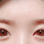 [댓글부탁해] +))<b>쌍수전</b> 추가사진!! <b>쌍수</b>후 눈화장 알려줄 예쁜사람