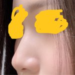 난 <b>코가</b> 조지게 높지