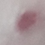 <b>잉가</b> 파데쿠션으로 이것도 커버 돼?