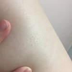 [조언부탁해] 아니 얘들아 나 무슨 병걸렸나