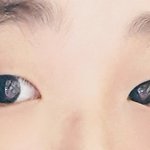 쌍수할까 <b>눈매</b>교정할까 둘다할까