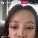 안검<b>하수</b> 때문에 성형했다는 구하라