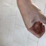 [이것좀봐줘] (사진있음)새**식당에서 종업원이 <b>화상</b>입혔습니다.