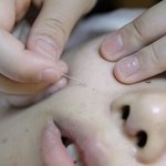 해본사람만 안다는 극한의 피부과 고통ㄷㄷ