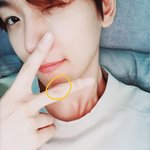 [EXO] 백현이 손가락 <b>다친거</b> 여기구나ㅠㅡㅠ