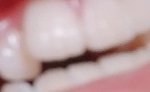 <b>이빨사진</b>)나 교정하는게 나을거같음?