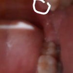 살짝 놀랄수잇어) 나 입 안이 <b>아파</b>