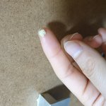 [댓글부탁해] <b>내</b> <b>입</b>에서 냄새 개쩌는 노란색 덩어리가 나왔어