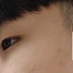 [점례점례] 블랙<b>헤드</b>가 너무 많은데 어떻게 해야될지모르겠어 도와줘ㅠ...