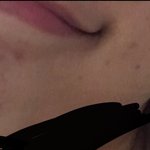 [댓글부탁해] 나 피부 짱조아졌지 ??