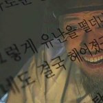 나만 치과 의외로 안아프냐