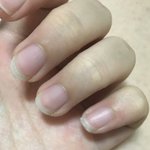 [댓글부탁해] 손톱 뜯지 말아야 되는<b>EU</b>