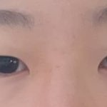 쌍수 <b>전후</b> 보고강