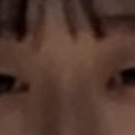 중 3 겨울방학때 쌍수