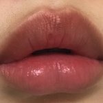 [댓글부탁해] 나 입술 <b>필러</b>맞은거 같지 아늠??