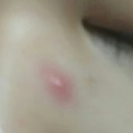 [드루와] 나 안경많이써서 여드름 개큰<b>거남</b>